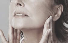 Žena pokazuje gubitak volumena rastezanjem kože lica.