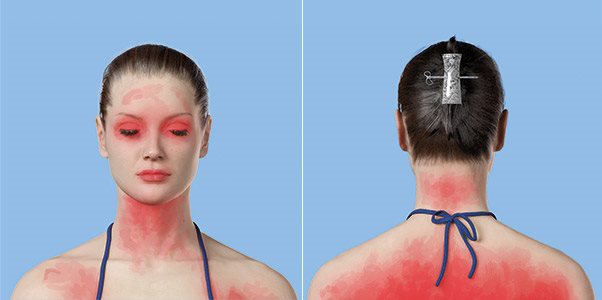 Temeljno nanesite praparat za zaštitu od sunca sa hijaluronskom kiselinom