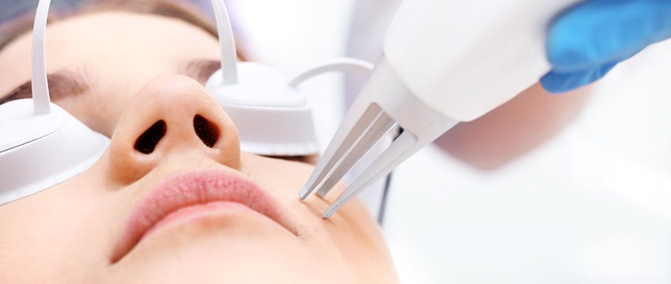 Laser treatment: laser treatment skin