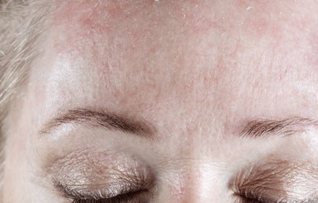 Ženino čelo koje se peruta